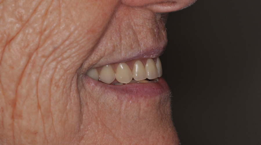dentures in manhattan