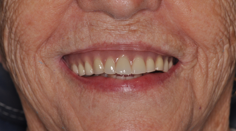 manhattan dentures