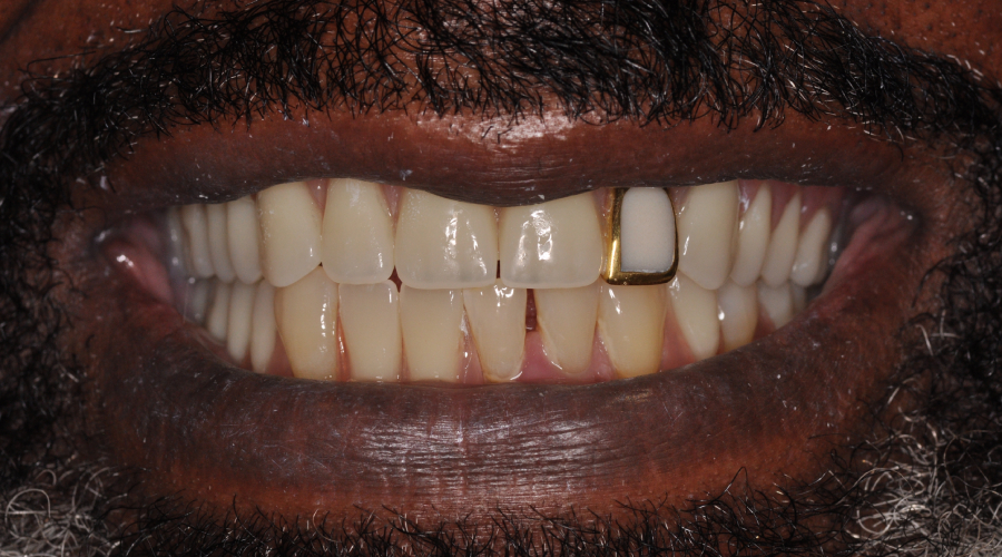 dentures in midtown manhattan