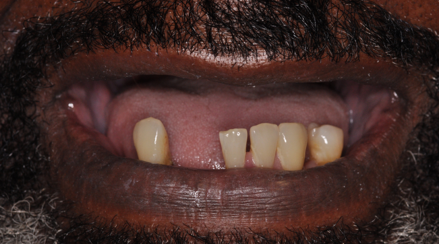 midtown manhattan dentures
