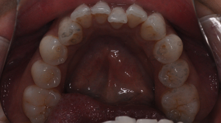 clear aligners in manhattan