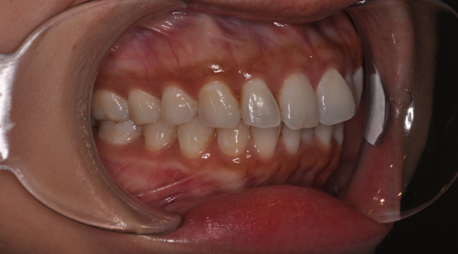 clear aligners manhattan
