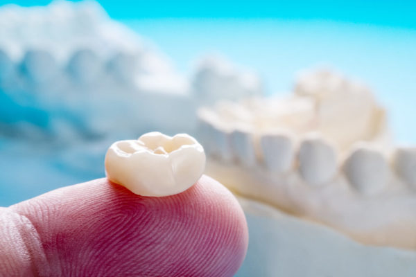 Chipped a Dental Crown? Here's What to Do | Blue Line Dental